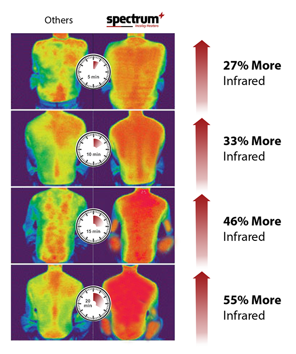 thermal image of heat on human body
